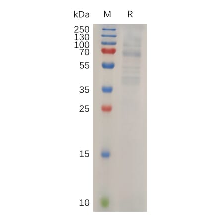 SDS-PAGE - Recombinant Human LIPG Protein (6×His Tag) (A318034) - Antibodies.com