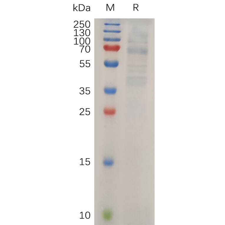 SDS-PAGE - Recombinant Human LIPG Protein (6×His Tag) (A318034) - Antibodies.com