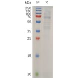 SDS-PAGE - Recombinant Human LIPG Protein (6×His Tag) (A318034) - Antibodies.com