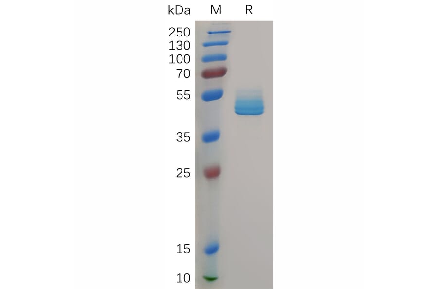 SDS-PAGE - Recombinant Human CD3 delta Protein (6xHis Tag) + CD3 epsilon Protein (Fc Tag) (A318035) - Antibodies.com
