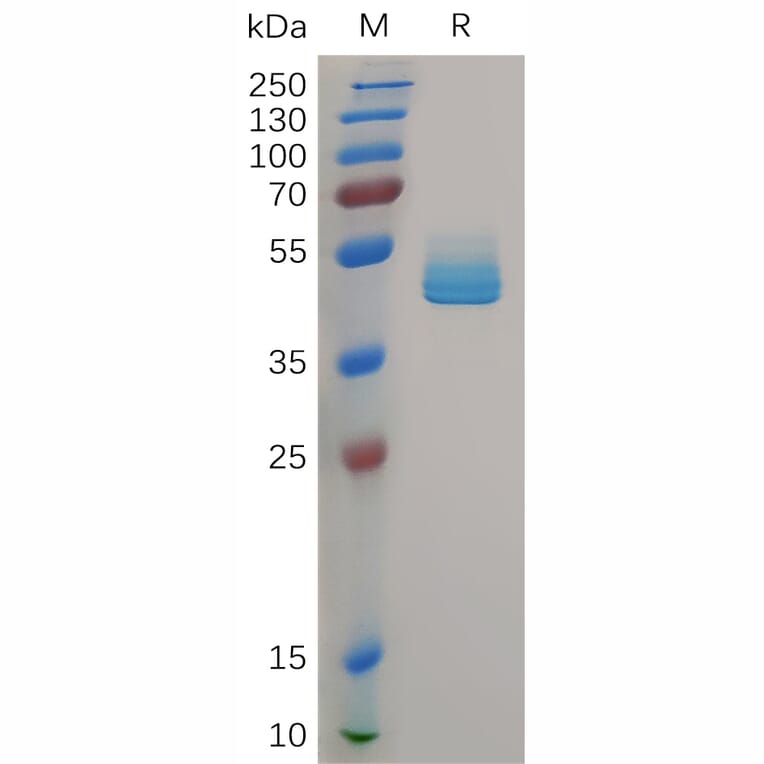 SDS-PAGE - Recombinant Human CD3 delta Protein (6xHis Tag) + CD3 epsilon Protein (Fc Tag) (A318035) - Antibodies.com