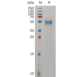 SDS-PAGE - Recombinant Human Prion Protein PrP Protein (Fc Tag) (A318036) - Antibodies.com