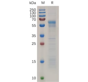 SDS-PAGE - Recombinant Human Prion Protein PrP Protein (Fc Tag) (A318037) - Antibodies.com