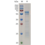 SDS-PAGE - Recombinant Human Prion Protein PrP Protein (Fc Tag) (A318037) - Antibodies.com
