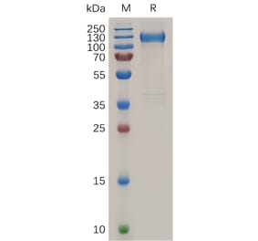 SDS-PAGE - Recombinant Human VEGF Receptor 1 Protein (6×His Tag) (A318038) - Antibodies.com