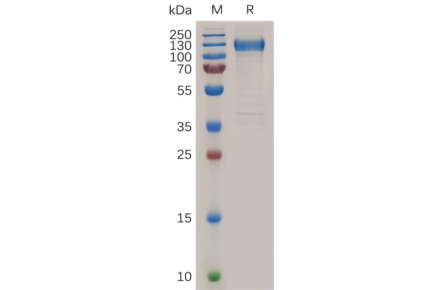 SDS-PAGE - Recombinant Human VEGF Receptor 1 Protein (6×His Tag) (A318038) - Antibodies.com