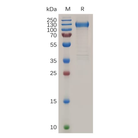 SDS-PAGE - Recombinant Human VEGF Receptor 1 Protein (6×His Tag) (A318038) - Antibodies.com