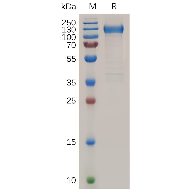 SDS-PAGE - Recombinant Human VEGF Receptor 1 Protein (6×His Tag) (A318038) - Antibodies.com