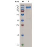 SDS-PAGE - Recombinant Human VEGF Receptor 1 Protein (6×His Tag) (A318038) - Antibodies.com