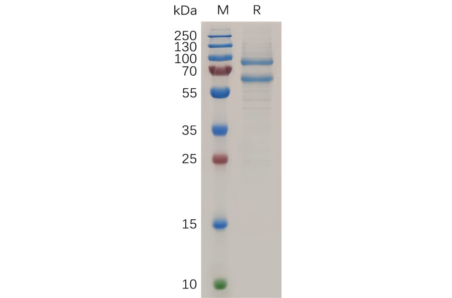 SDS-PAGE - Recombinant Human MS2 Protein (6×His Tag) (A318039) - Antibodies.com