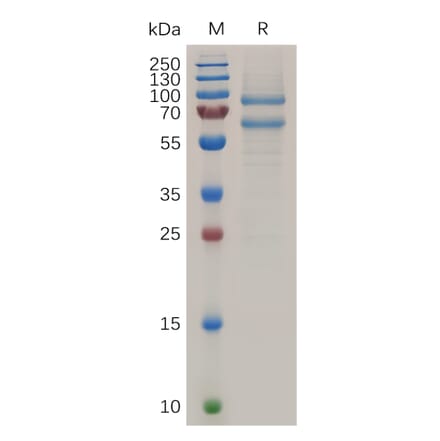 SDS-PAGE - Recombinant Human MS2 Protein (6×His Tag) (A318039) - Antibodies.com