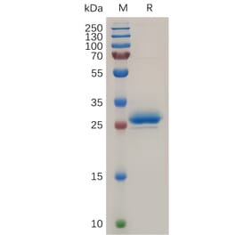 SDS-PAGE - Recombinant Human Mesothelin Protein (6×His Tag) (A318040) - Antibodies.com