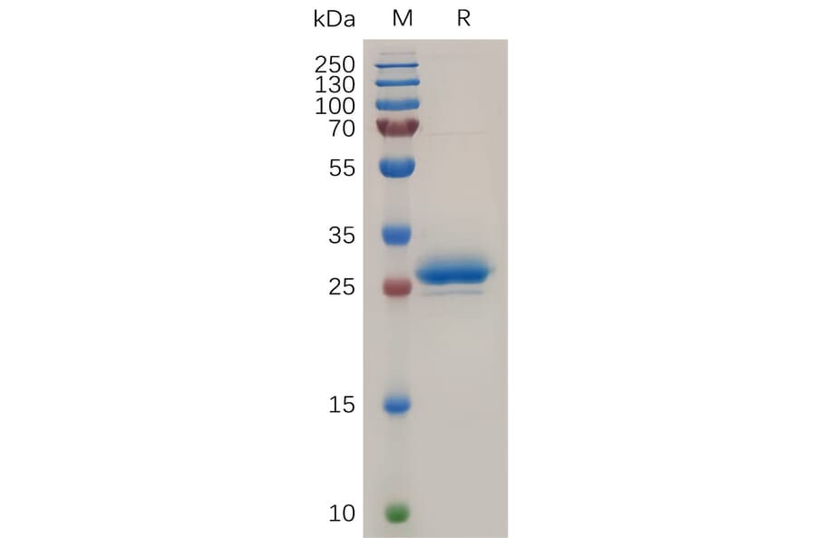 SDS-PAGE - Recombinant Human Mesothelin Protein (6×His Tag) (A318040) - Antibodies.com