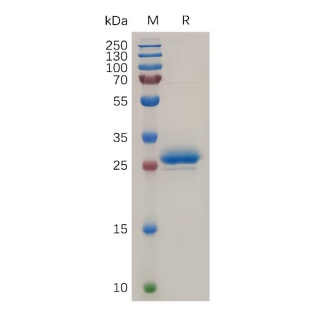 SDS-PAGE - Recombinant Human Mesothelin Protein (6×His Tag) (A318040) - Antibodies.com