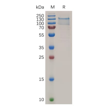 SDS-PAGE - Recombinant Human TEM1 Protein (6×His Tag) (A318041) - Antibodies.com