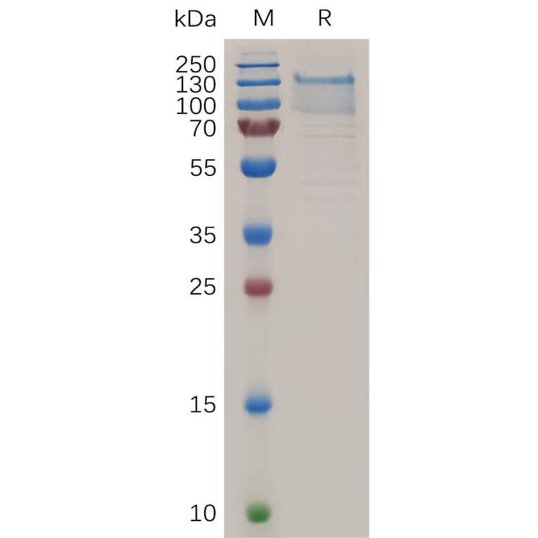 SDS-PAGE - Recombinant Human TEM1 Protein (6×His Tag) (A318041) - Antibodies.com