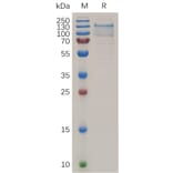 SDS-PAGE - Recombinant Human TEM1 Protein (6×His Tag) (A318041) - Antibodies.com