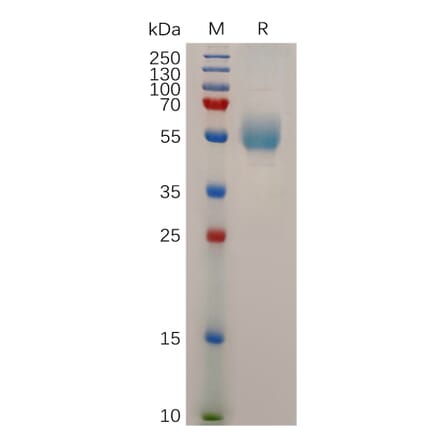 SDS-PAGE - Recombinant Human Glucagon Receptor Protein (Fc Tag) (A318042) - Antibodies.com