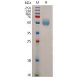 SDS-PAGE - Recombinant Human Glucagon Receptor Protein (Fc Tag) (A318042) - Antibodies.com