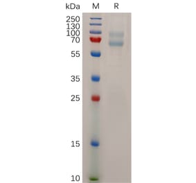 SDS-PAGE - Recombinant Human ADAM28 Protein (6×His Tag) (A318043) - Antibodies.com