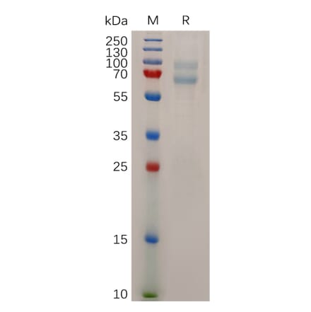 SDS-PAGE - Recombinant Human ADAM28 Protein (6×His Tag) (A318043) - Antibodies.com