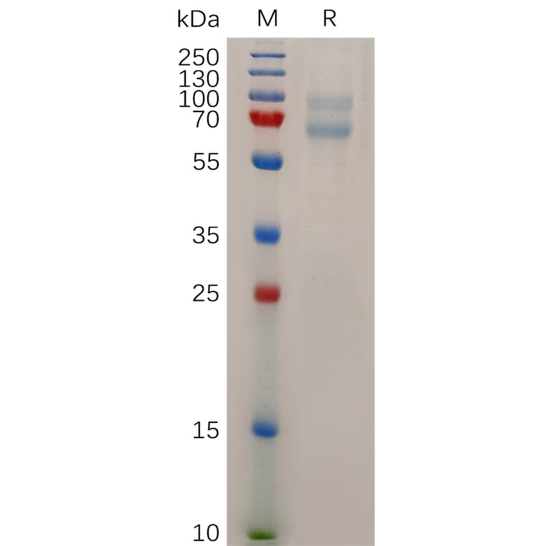 SDS-PAGE - Recombinant Human ADAM28 Protein (6×His Tag) (A318043) - Antibodies.com