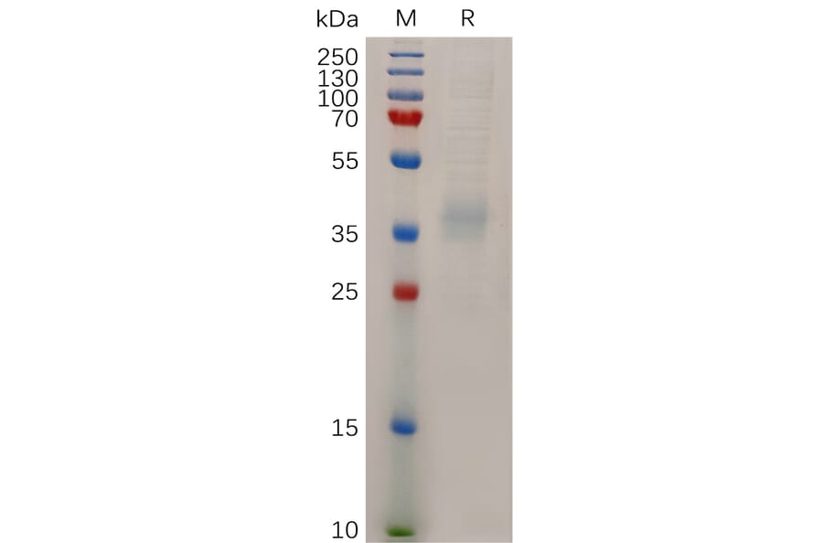 SDS-PAGE - Recombinant Human Niemann Pick C1 Like 1/NPC1L1 Protein (6×His Tag) (A318044) - Antibodies.com