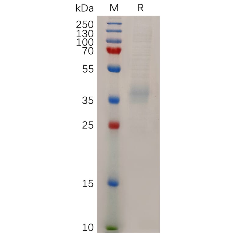 SDS-PAGE - Recombinant Human Niemann Pick C1 Like 1/NPC1L1 Protein (6×His Tag) (A318044) - Antibodies.com