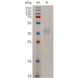 SDS-PAGE - Recombinant Human Niemann Pick C1 Like 1/NPC1L1 Protein (6×His Tag) (A318044) - Antibodies.com