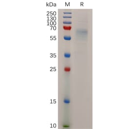 SDS-PAGE - Recombinant Human STAB1 Protein (6×His Tag) (A318045) - Antibodies.com