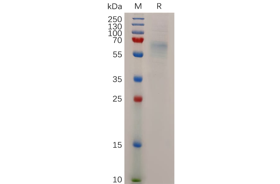 SDS-PAGE - Recombinant Human STAB1 Protein (6×His Tag) (A318045) - Antibodies.com