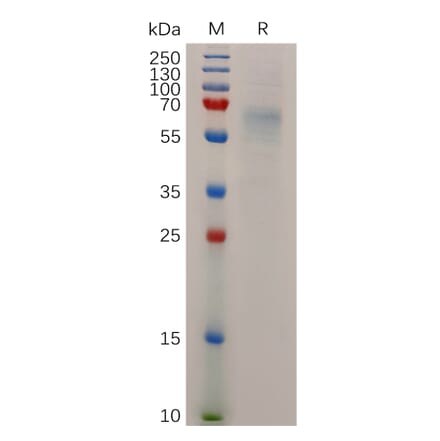 SDS-PAGE - Recombinant Human STAB1 Protein (6×His Tag) (A318045) - Antibodies.com