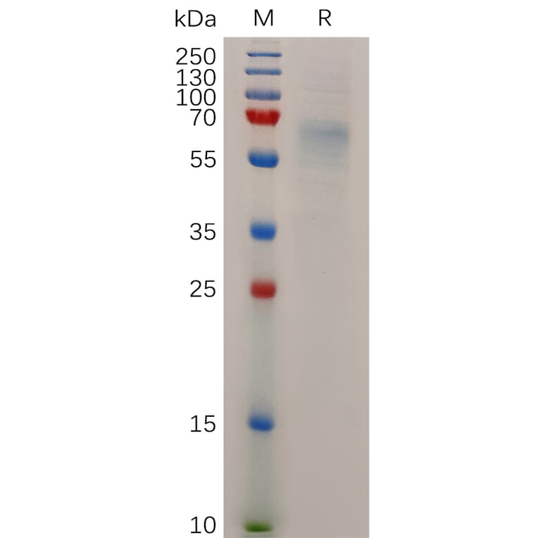 SDS-PAGE - Recombinant Human STAB1 Protein (6×His Tag) (A318045) - Antibodies.com