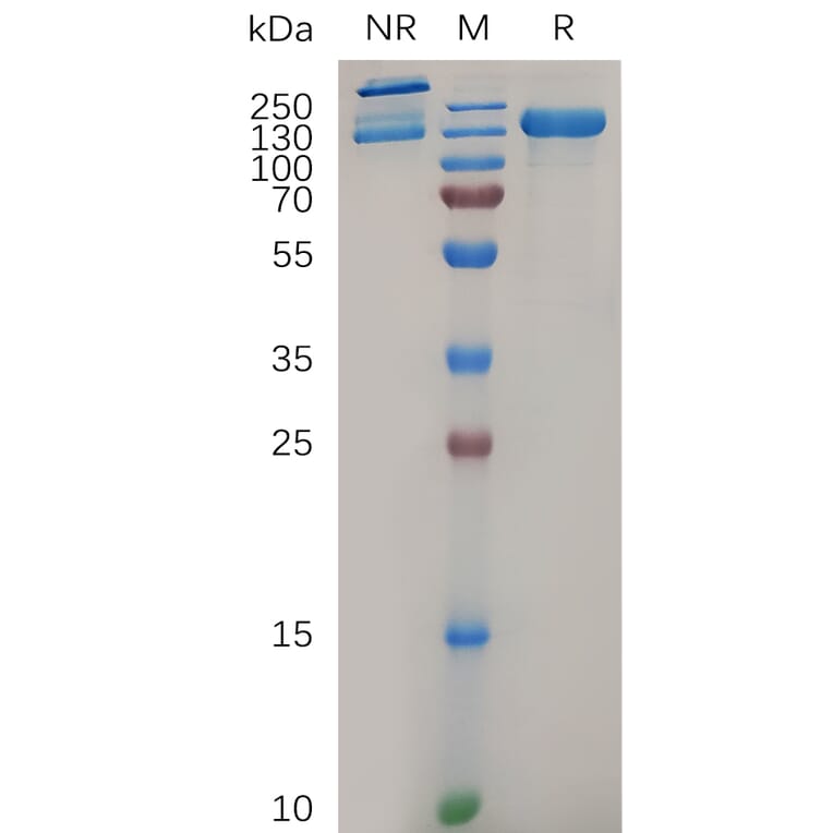 SDS-PAGE - Recombinant Human Integrin alpha 2 Protein (6xHis Tag) + Integrin beta 1 Protein (Fc Tag) Heterodimer (A318046) - Antibodies.com