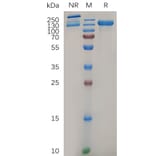 SDS-PAGE - Recombinant Human Integrin alpha 2 Protein (6xHis Tag) + Integrin beta 1 Protein (Fc Tag) Heterodimer (A318046) - Antibodies.com
