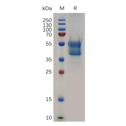 SDS-PAGE - Recombinant Human Glycophorin A Protein (Fc Tag) (A318047) - Antibodies.com