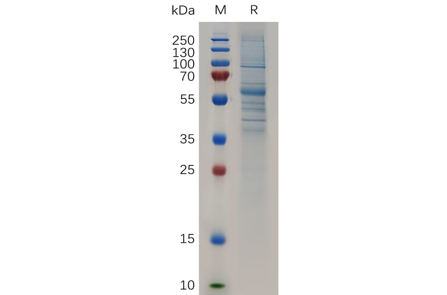 SDS-PAGE - Recombinant Human SCUBE2 Protein (Fc Tag) (A318048) - Antibodies.com