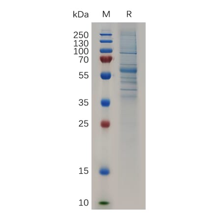 SDS-PAGE - Recombinant Human SCUBE2 Protein (Fc Tag) (A318048) - Antibodies.com