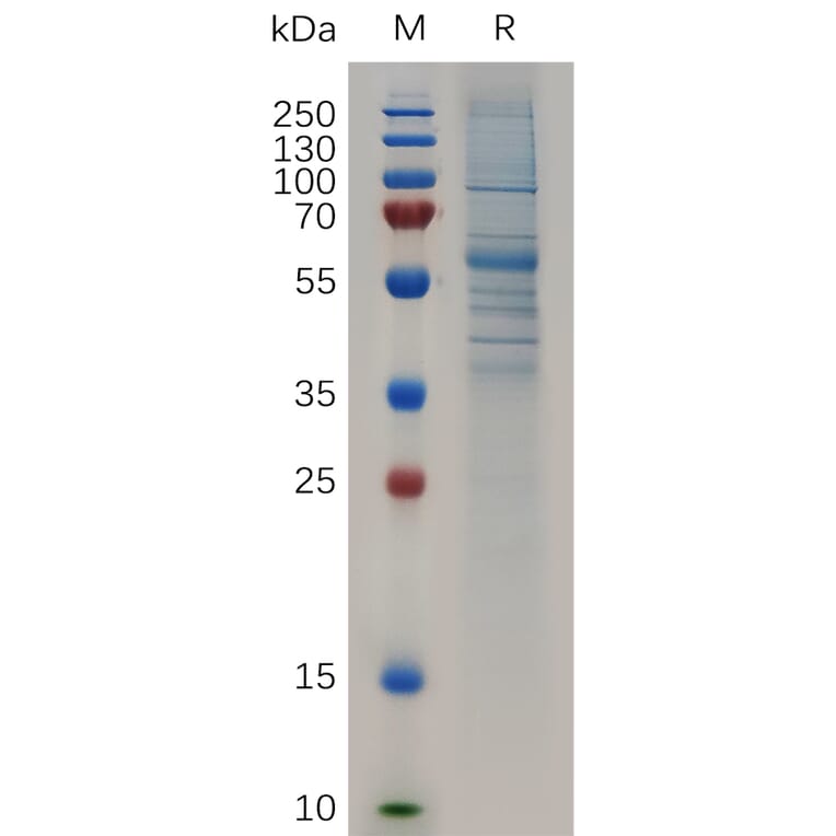 SDS-PAGE - Recombinant Human SCUBE2 Protein (Fc Tag) (A318048) - Antibodies.com