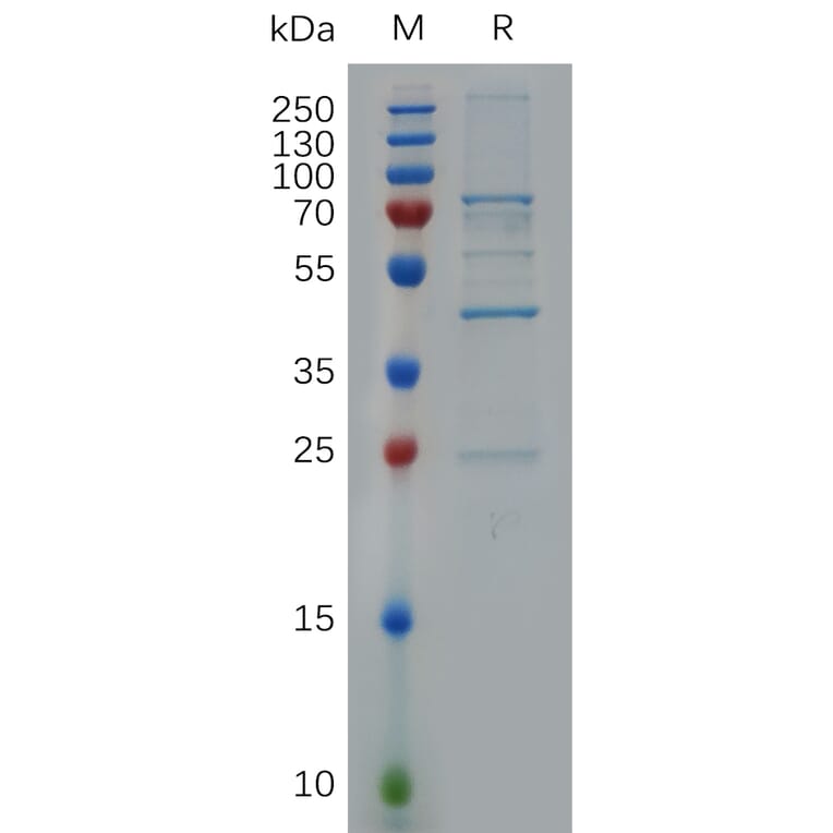 SDS-PAGE - Recombinant Human ERAB Protein (S Tag) (A318049) - Antibodies.com