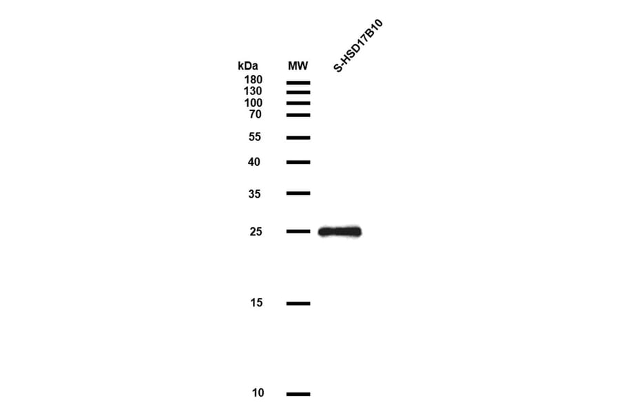 SDS-PAGE - Recombinant Human ERAB Protein (S Tag) (A318049) - Antibodies.com