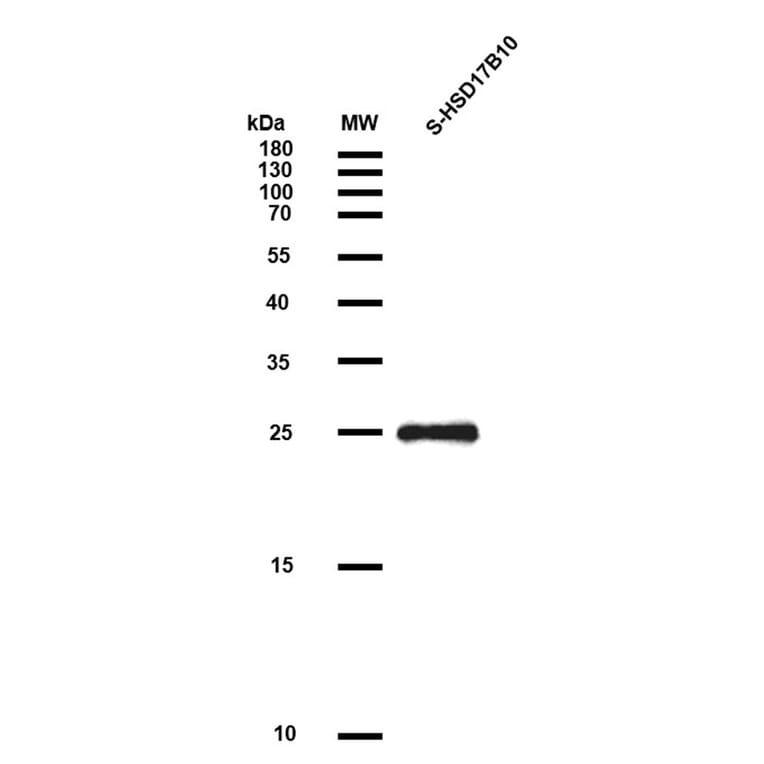 SDS-PAGE - Recombinant Human ERAB Protein (S Tag) (A318049) - Antibodies.com