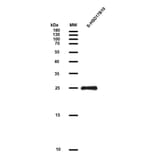 SDS-PAGE - Recombinant Human ERAB Protein (S Tag) (A318049) - Antibodies.com