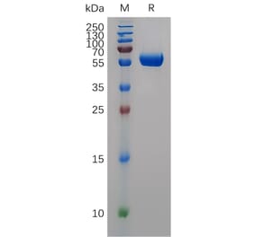 SDS-PAGE - Recombinant Human MMP9 Protein (6×His Tag) (A318050) - Antibodies.com