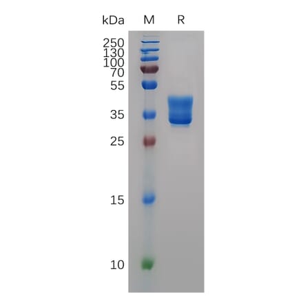 SDS-PAGE - Recombinant Human HCST Protein (Fc Tag) (A318051) - Antibodies.com