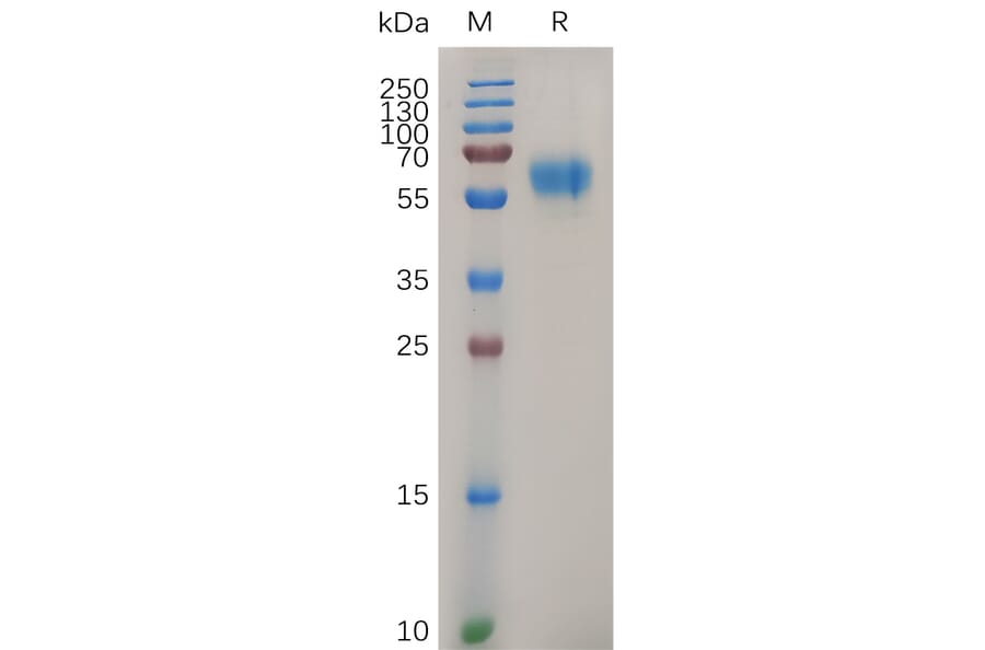SDS-PAGE - Recombinant Human MCK10/NEP Protein (6×His Tag) (A318052) - Antibodies.com