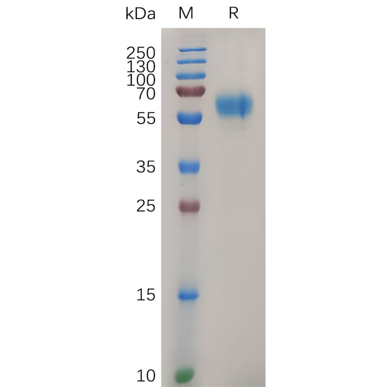 SDS-PAGE - Recombinant Human MCK10/NEP Protein (6×His Tag) (A318052) - Antibodies.com