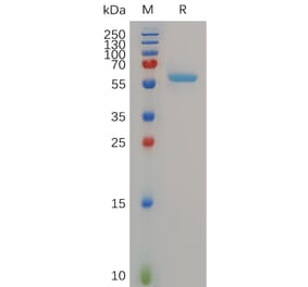 SDS-PAGE - Recombinant Human MMP13 Protein (6×His Tag) (A318054) - Antibodies.com