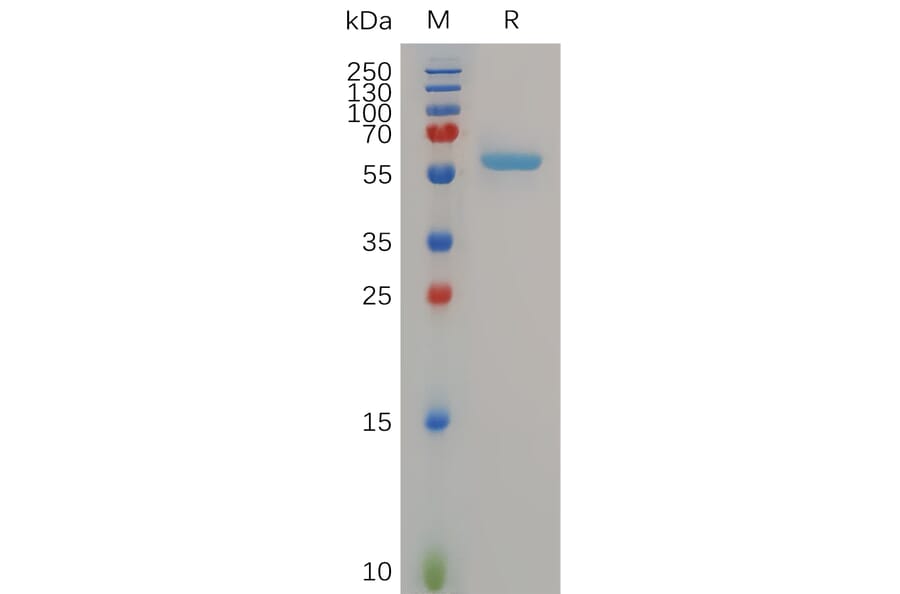 SDS-PAGE - Recombinant Human MMP13 Protein (6×His Tag) (A318054) - Antibodies.com