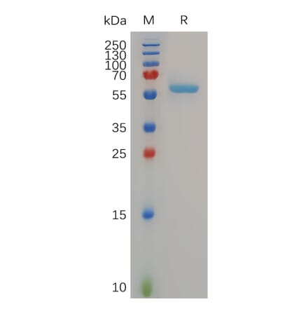 SDS-PAGE - Recombinant Human MMP13 Protein (6×His Tag) (A318054) - Antibodies.com